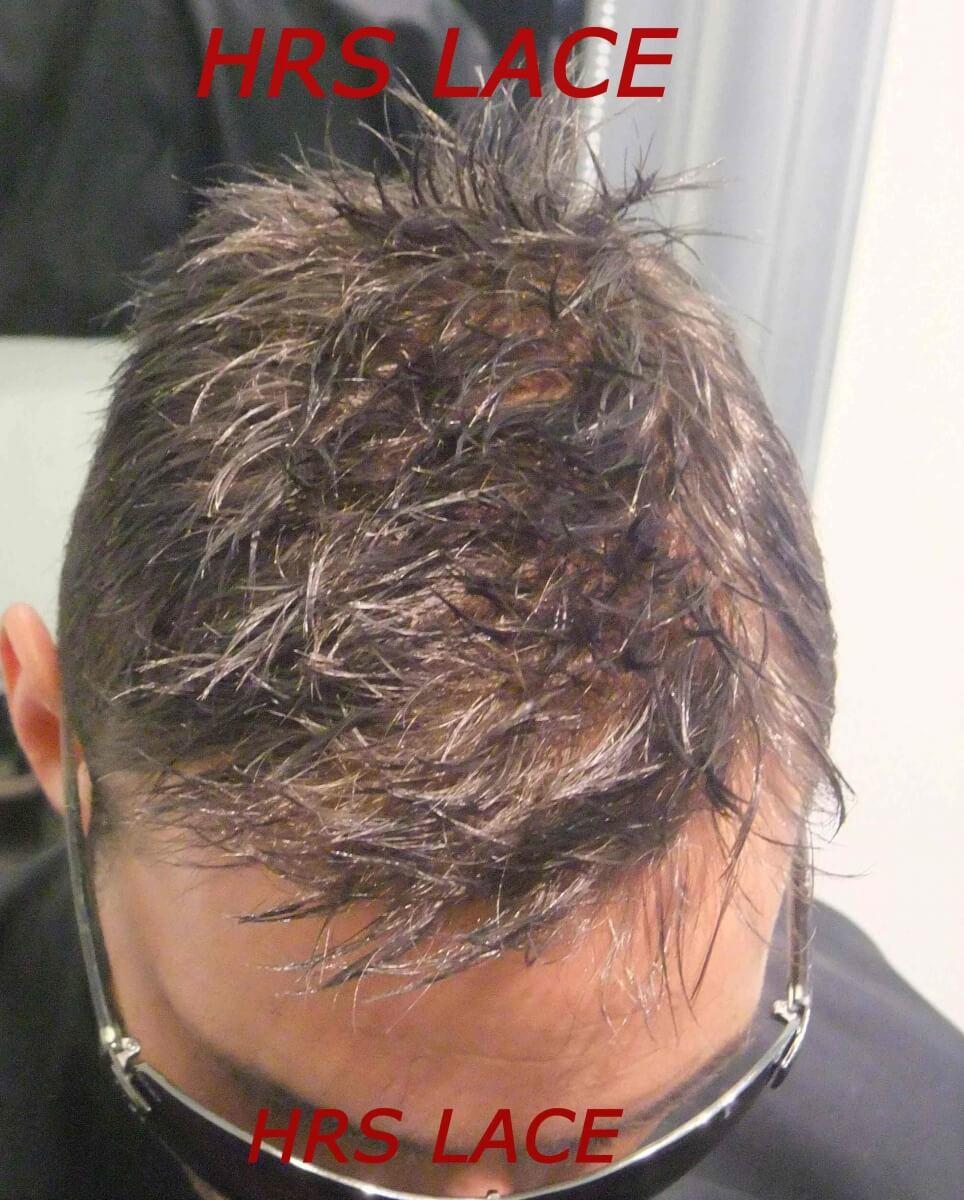 hrs capelli