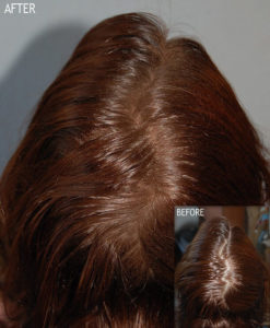 anti diradamento capelli
