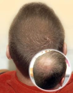 anti diradamento capelli