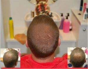 prodotti-antidiradamento-capelli-hrs