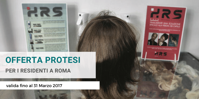 protesi capelli roma