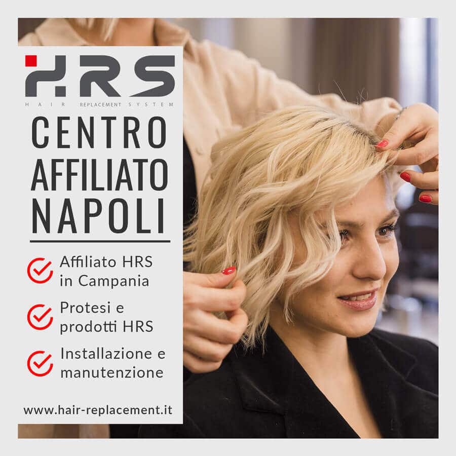 protesi capelli napoli