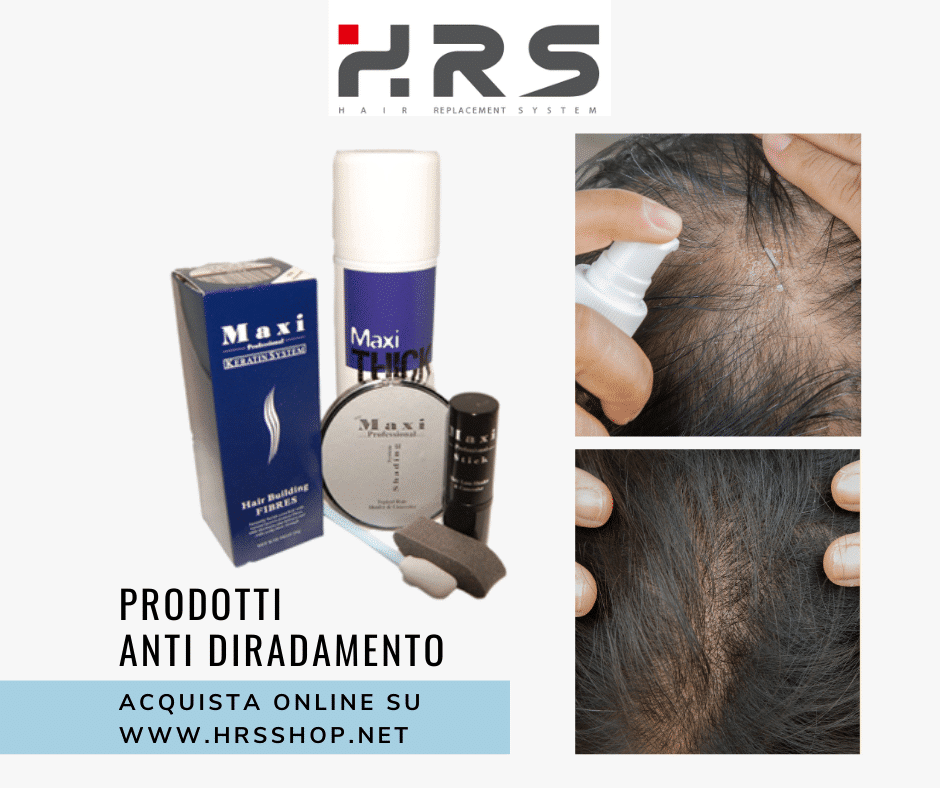 diradamento capelli uomo